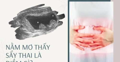 Nằm mơ thấy sảy thai báo hiệu điềm lành hay dữ? Đánh số mấy