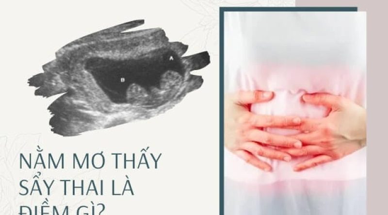 Nằm mơ thấy sảy thai báo hiệu điềm lành hay dữ? Đánh số mấy